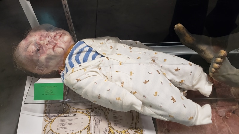 xf-museum-mutato-baby