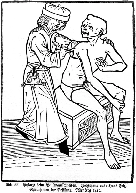 A plague doctor lancing a bubo, woodblock print, 1482, Germany, via World of Habsburgs