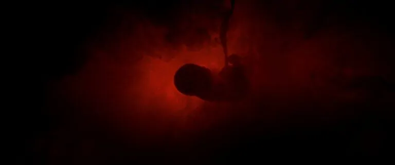 LILY LIVES ALONE (Credit: Martin Melnick)